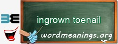 WordMeaning blackboard for ingrown toenail